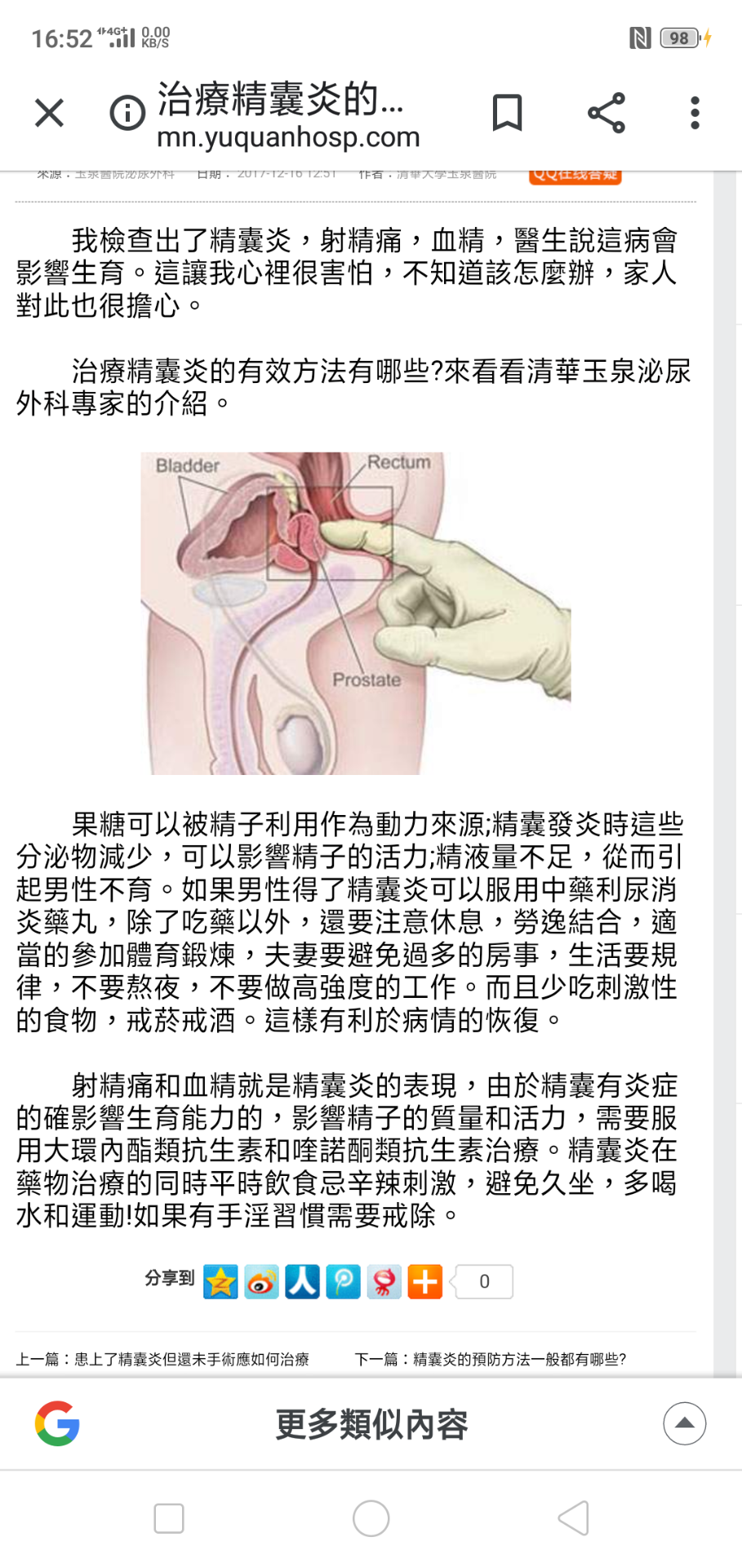 醫療文章截圖，含泌尿生殖示意圖與文字說明，頁面顯示治療精囊炎內容。